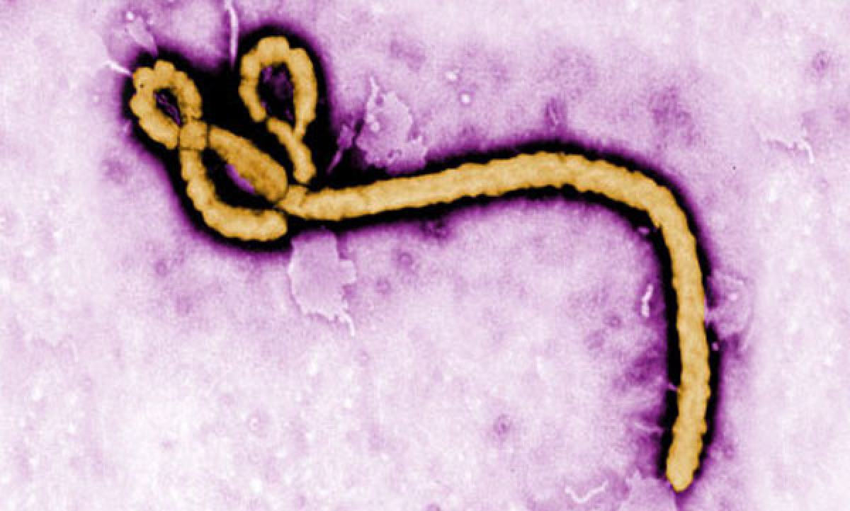 ¿Qué es la enfermedad por el virus del ébola?