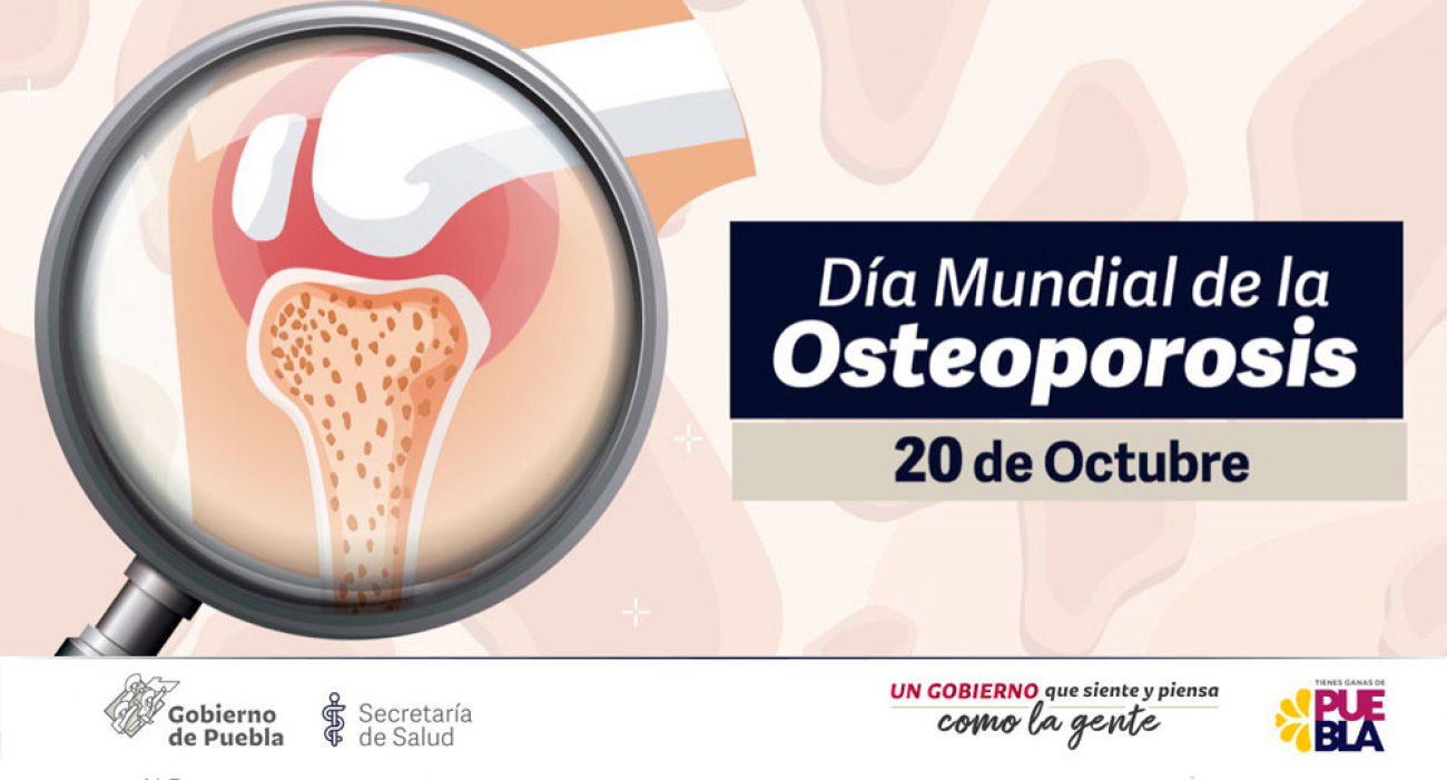 Día Mundial de la Osteoporosis