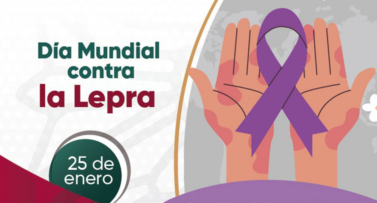 D&iacute;a Mundial contra la Lepra