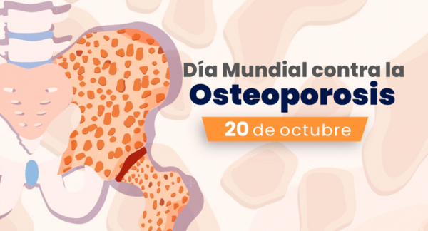 Día Mundial contra la Osteoporosis