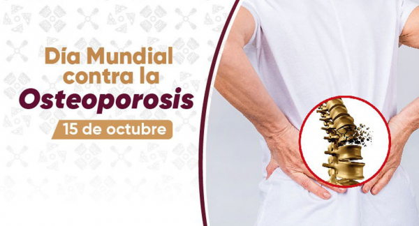 Día Mundial contra la Osteoporosis