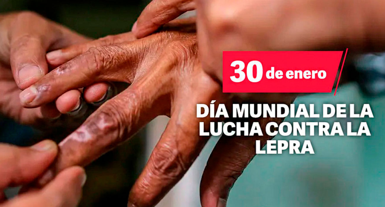 Día Mundial de la lucha contra la lepra