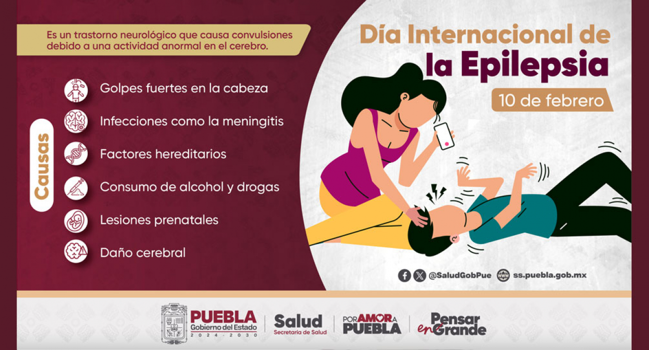 Día internacional de la Epilepsia