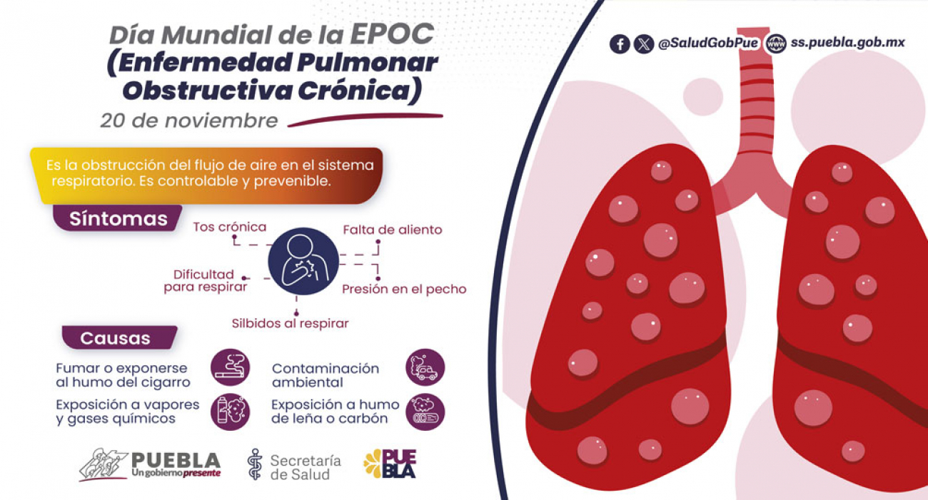 Enfermedad pulmonar obstructiva crónica