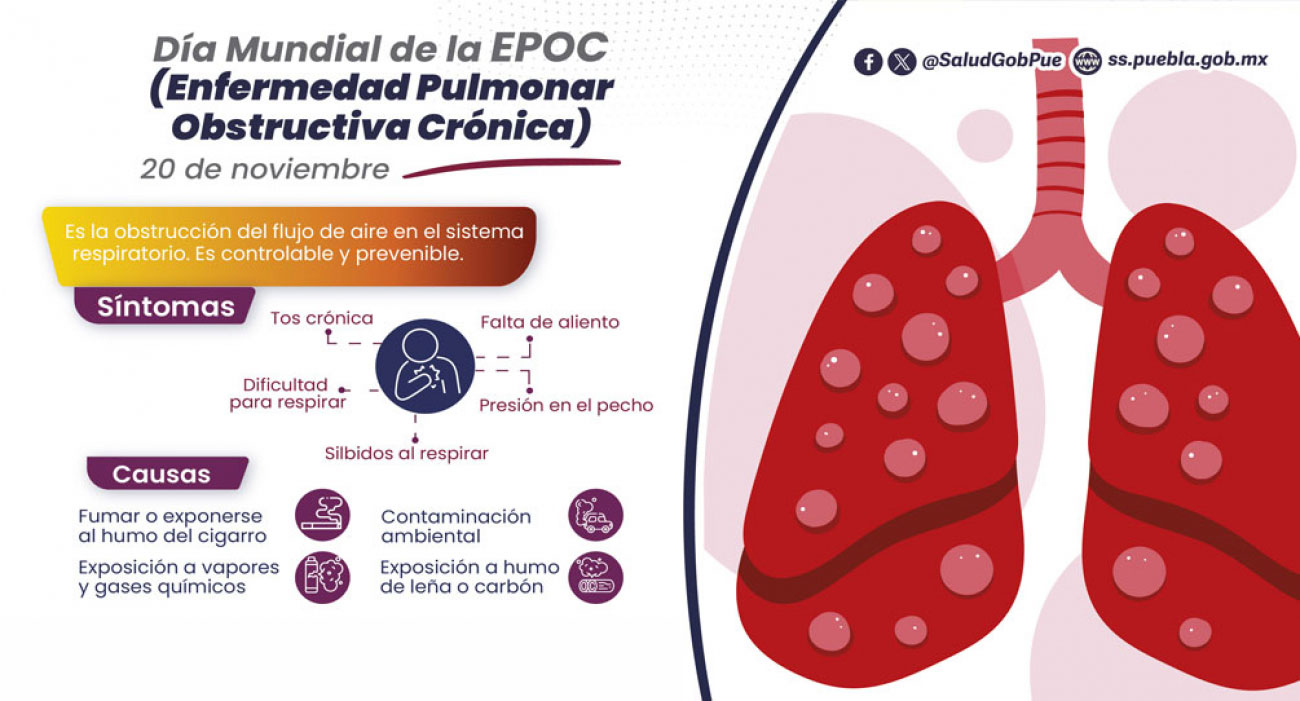 Enfermedad pulmonar obstructiva crónica