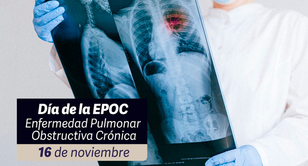 Día Mundial De La Enfermedad Pulmonar Obstructiva Crónica