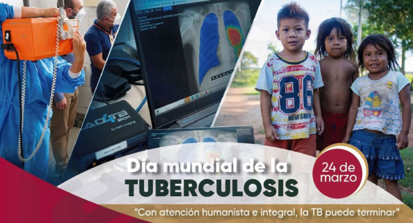 D&iacute;a Mundial de la Tuberculosis