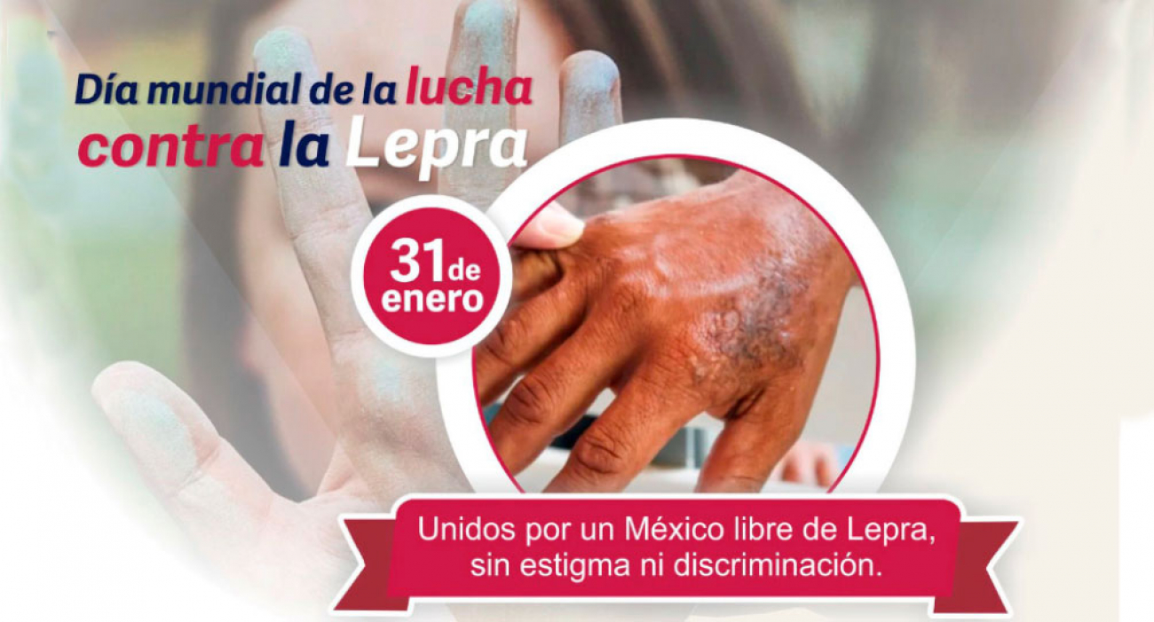 Día Mundial de la  lucha contra la Lepra